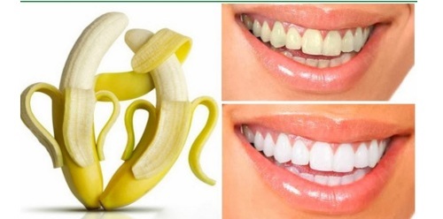 Гадил жимсний хальсаар шүдээ цайруулцгаая